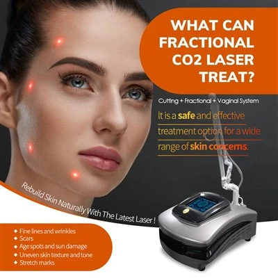 Nyeste CO2 -lasermaskinhudoverflater