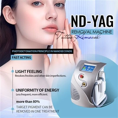 Tatoveringsfjerning Q -bryter ND YAG -laser